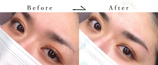 ４D眉毛アートメイク症例写真