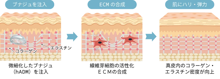 ブナジュのメカニズム